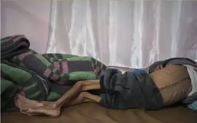 غزة.. 4 حالات وفاة جديدة نتيجة