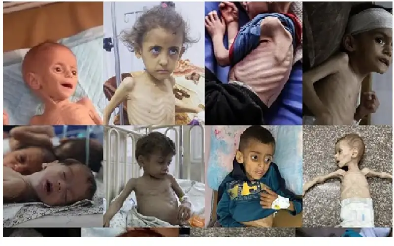 5 وفيات جديدة بسبب المجاعة في