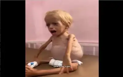 الموت بالرصاص… والموت بالقصف… والموت بالتجويع