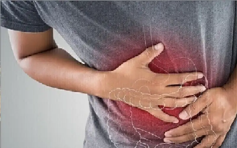 أطعمة تسبب حرقة المعدة