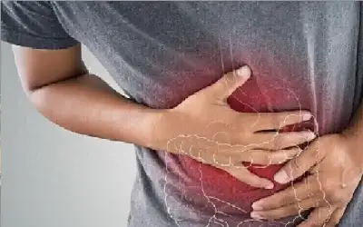 أطعمة تسبب حرقة المعدة