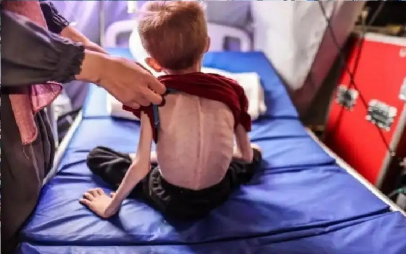 ارتفاع شهداء التجويع في غزة الى