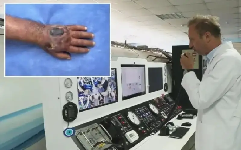 عضة لص تصيب ستيني بعدوى خطيرة