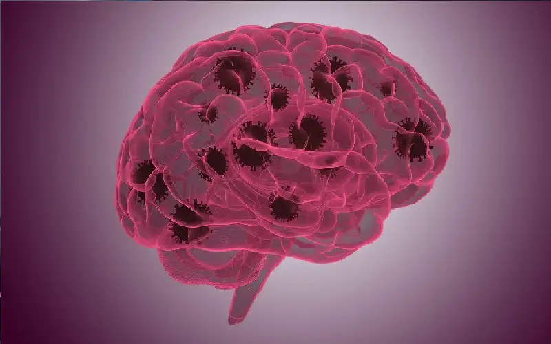 6 تعديلات تخفف ضبابية الدماغ خلال