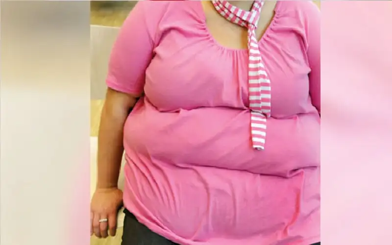 متلازمة التمثيل الغذائي ترتبط بمرض باركنسون