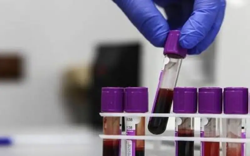 عالم أمريكي يفجر مفاجأة كبرى عن