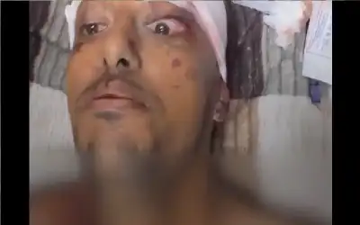 الاستهداف كان مباشرا للصحفيين.. الصحفي محمد