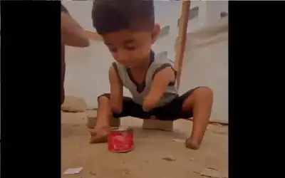 امير طفل مسلم من غزة.. قطعت