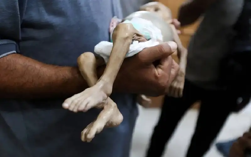 10 حالات وفاة نتيجة المجاعة وسوء