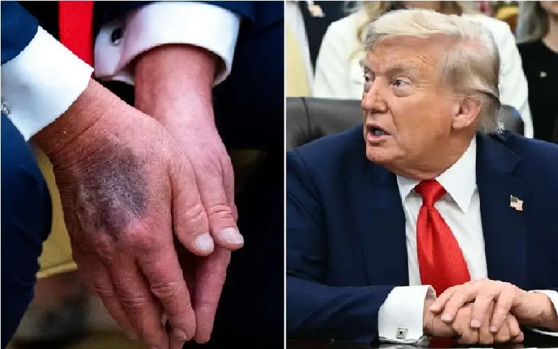 شائعات وفاة ترامب .. ماذا يحدث