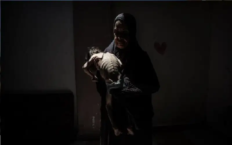 7 شهداء نتيجة التجويع في غزة