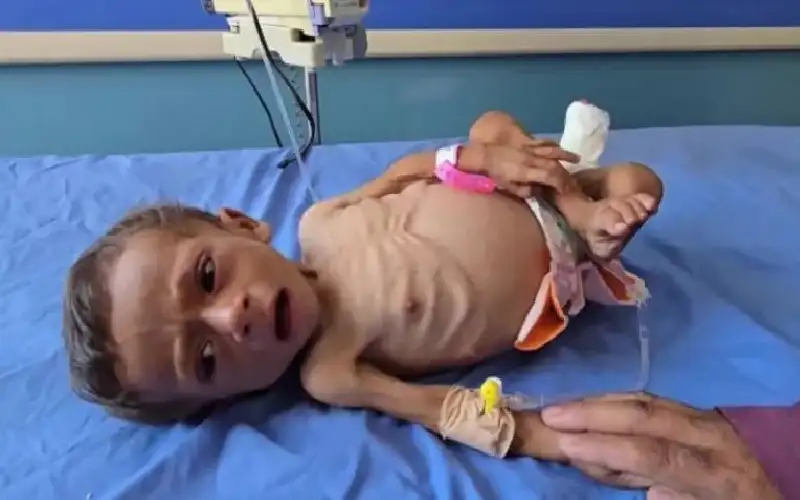 في أعلى حصيلة منذ أشهر: شهداء