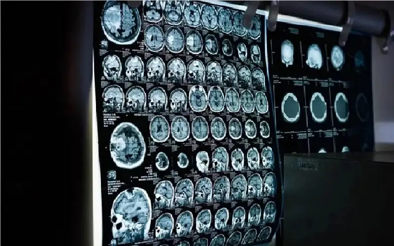 اختبار منزلي بـ3 دقائق يكشف علامات