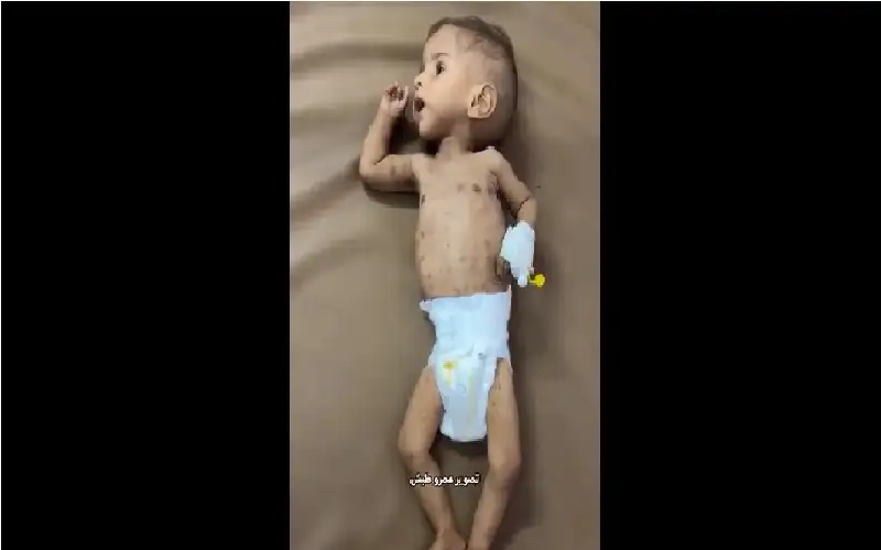 عن حقوق الطفل.. الرضيع علي أبو