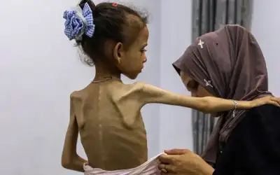 ارتفاع ضحايا المجاعة في غزة إلى