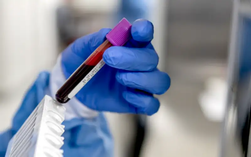 تحذيرات من تدهور خدمات المختبرات ووحدات