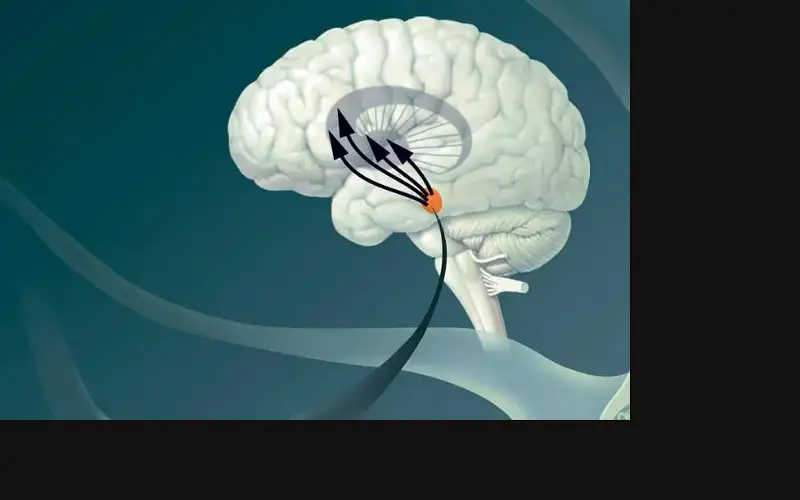 توصيل الأدوية للدماغ بفتح الحاجز الدماغي