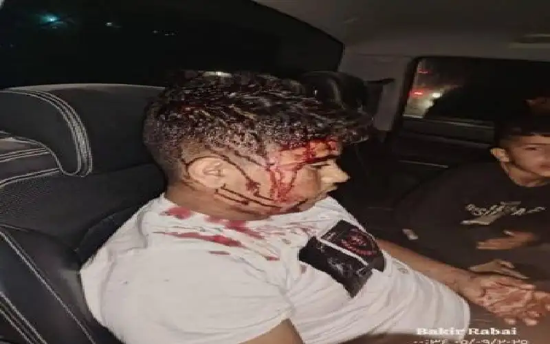 شاهد قي الضفة وليس غزة.. اصابة