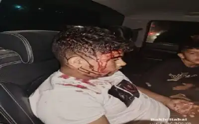 شاهد قي الضفة وليس غزة.. اصابة