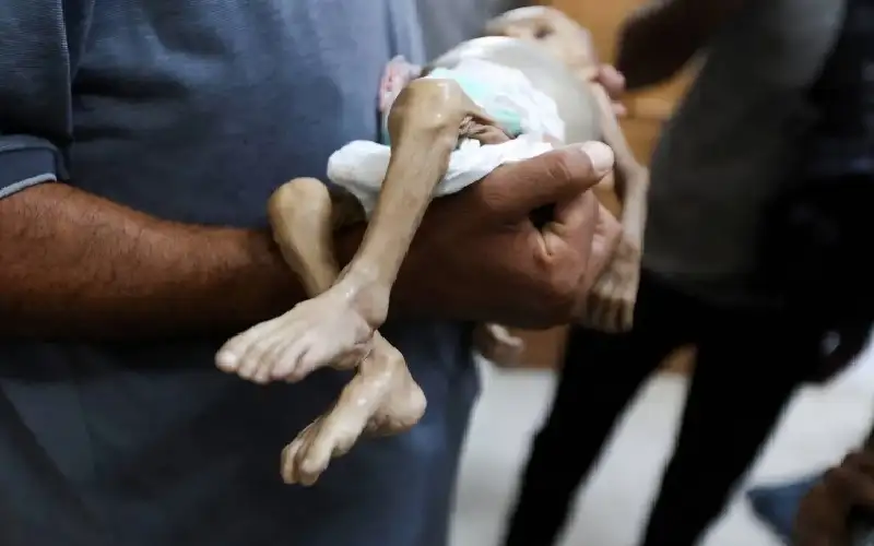 من بينهم 3 أطفال- 5 حالات