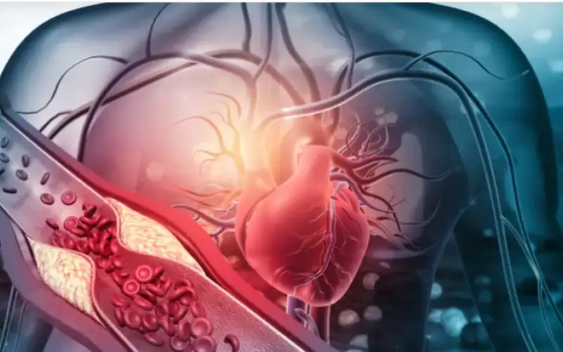 5 عادات يومية يمكن أن تسبب