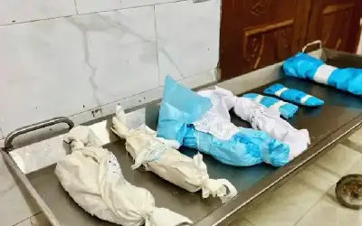 وفاة 13 طفلا بينهم 10 أجنة