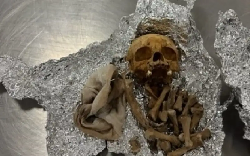 رعب في مطار فلوريدا.. جمجمة وفقرات