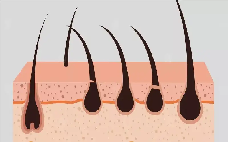 شعرك متقصف وفروة رأسك ملتهبة؟