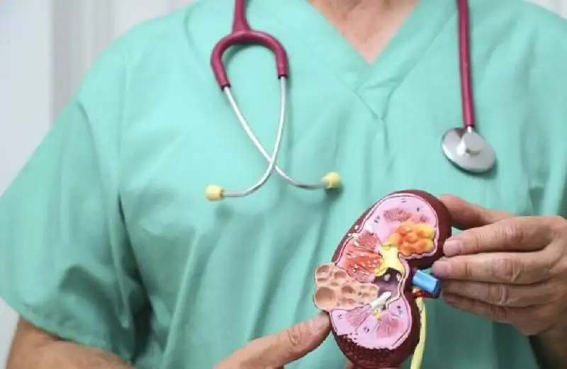 علامات خفية لأمراض الكلى
