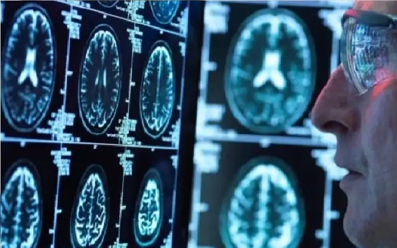 4 عادات تحميك من الخرف وأمراض