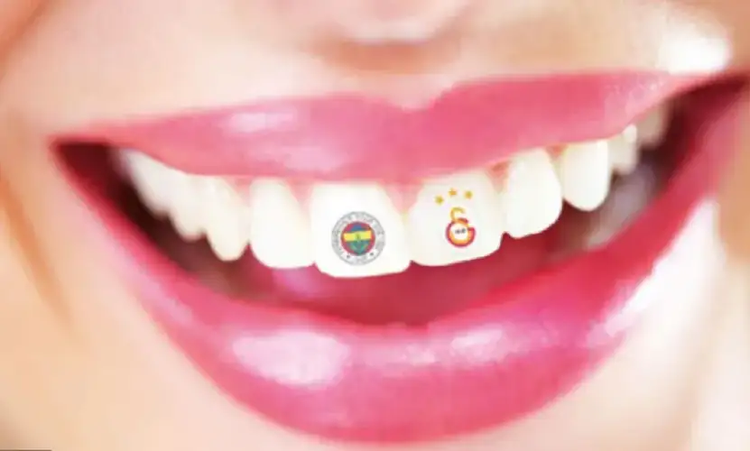 تاتو الأسنان فى الصين .. تريند