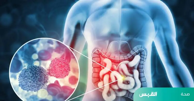 تحديد هدف علاجي جديد لسرطان البنكرياس