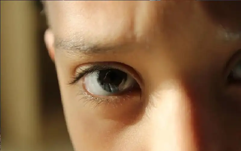 هل تتدهور صحة عيون الأطفال بسبب