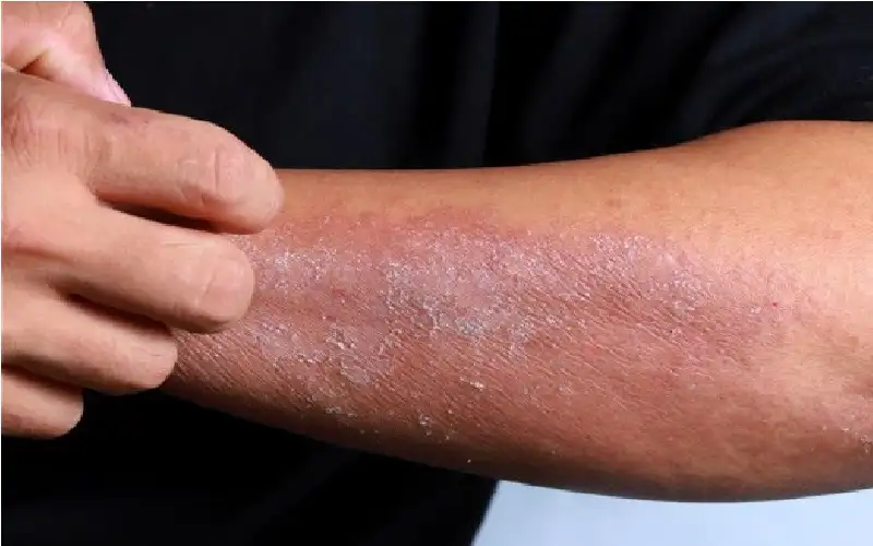 طبيب جلدية يحذر: 4 منتجات قد