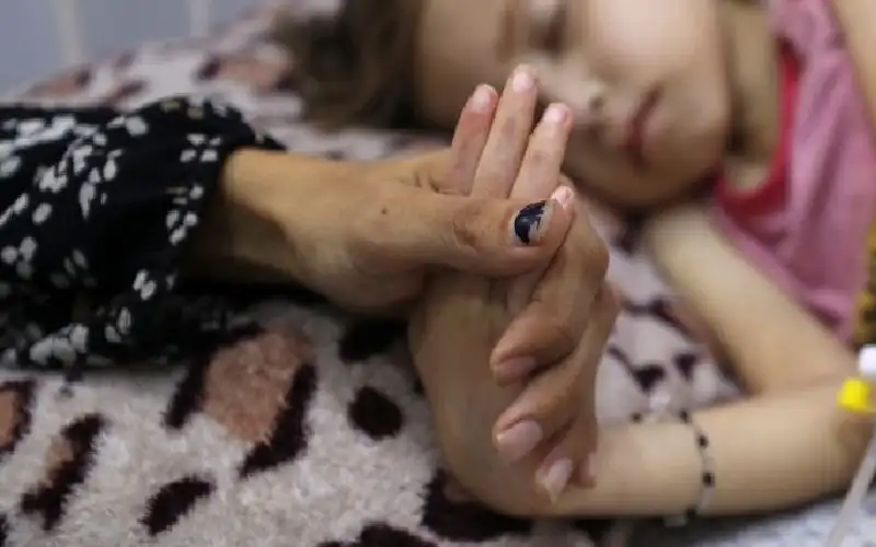 وفاتان نتيجة المجاعة وسوء التغذية بغزة