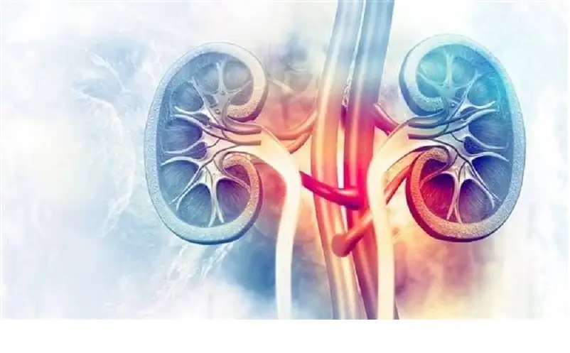 ما هي متلازمة ألبورت النادرة؟