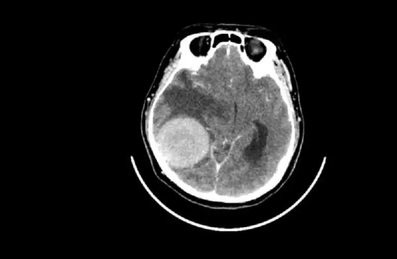 دراسة صادمة .. القلق والدوار يرتبطان