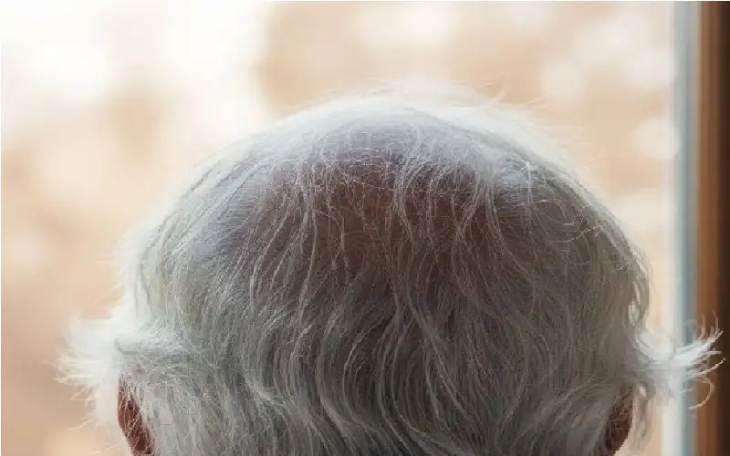 الشيب وسرطان الجلد.. كيف خلق الله