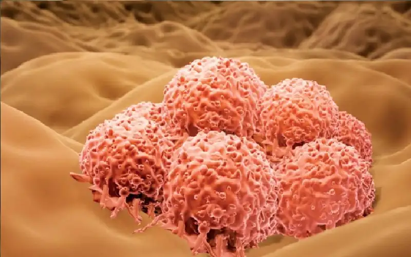 رقعة ذكية تكشف سرطان الجلد