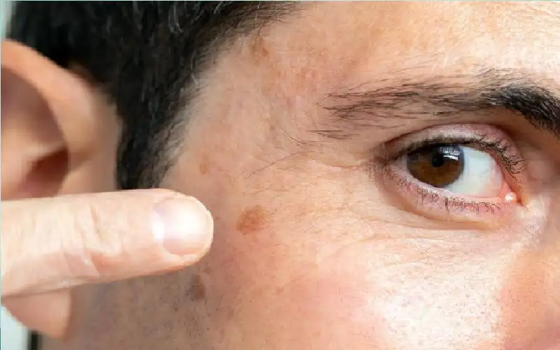 تطوير رقعة ذكية جديدة للكشف المبكر