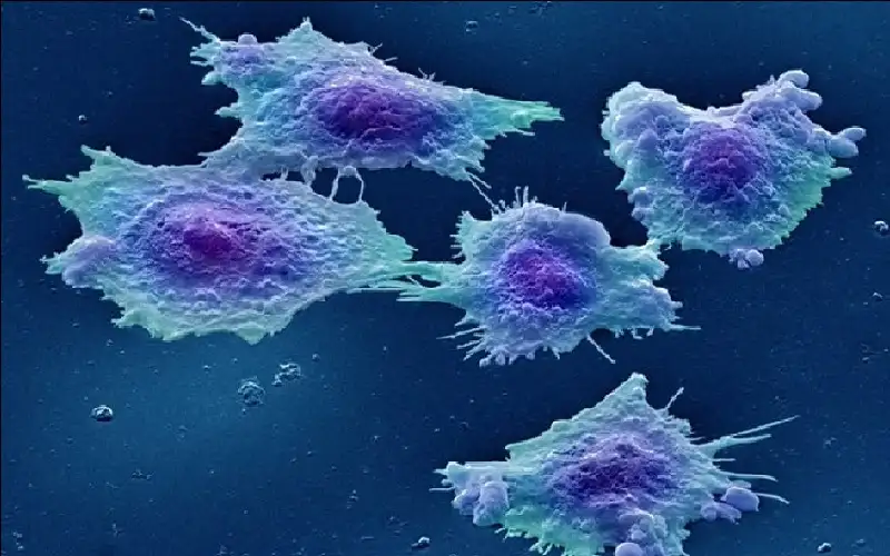 في 30 دقيقة فقط.. علاج رائد