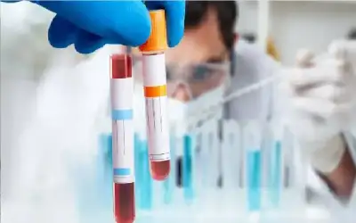 بدقة عالية.. اختبار دم متطور يكشف