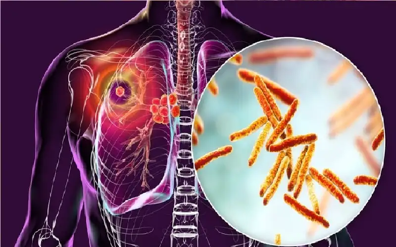 بأول لقاح منذ قرن.. العلم يقترب