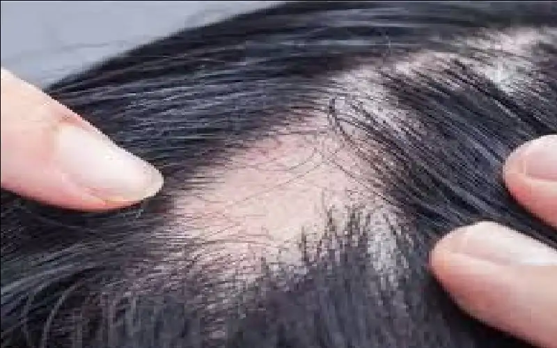 خلال 56 يوما فقط.. مصل سحري