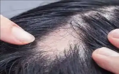 خلال 56 يوما فقط.. مصل سحري