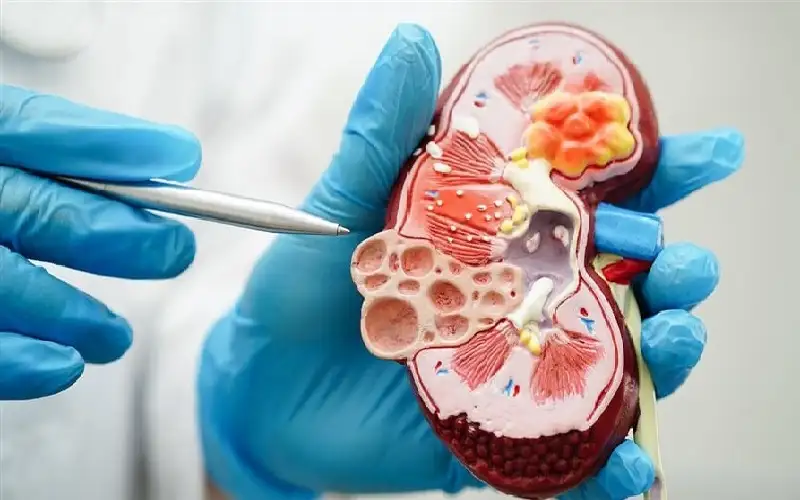 ارتفاع عالمي للإصابات بمرض قاتل يدخل