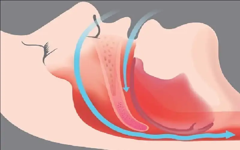منها الشخير.. 5 عادات نوم خاطئة