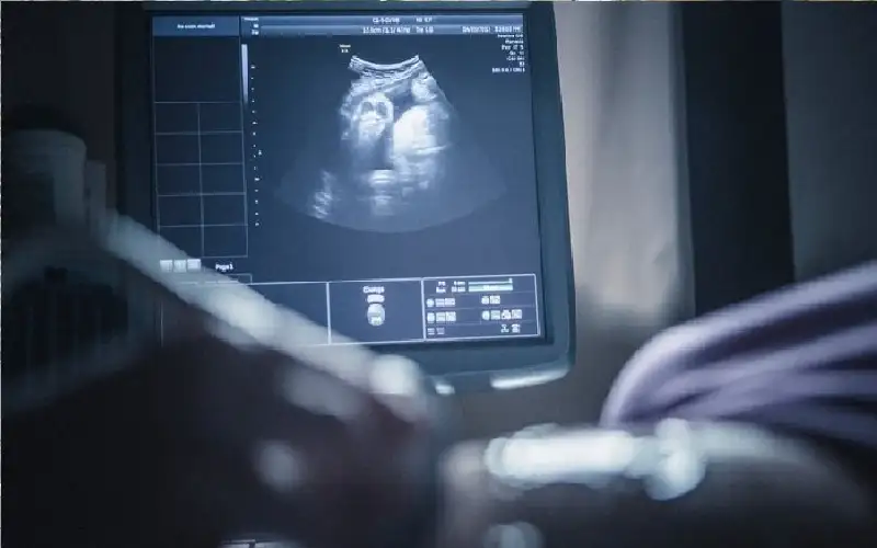 استخدمت أدوية تنشيط المبايض من دون