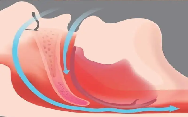 طبيب يكشف تمرينا بسيطا مدته 30