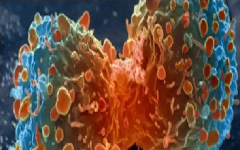 آلية جديدة تفتح آفاقا لعلاج سرطان